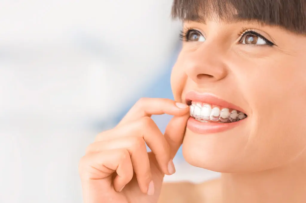 Invisalign® - North Royalton, OH