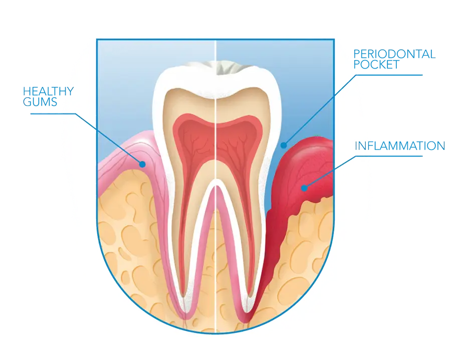 Pinhole® Surgical Technique - North Royalton, OH