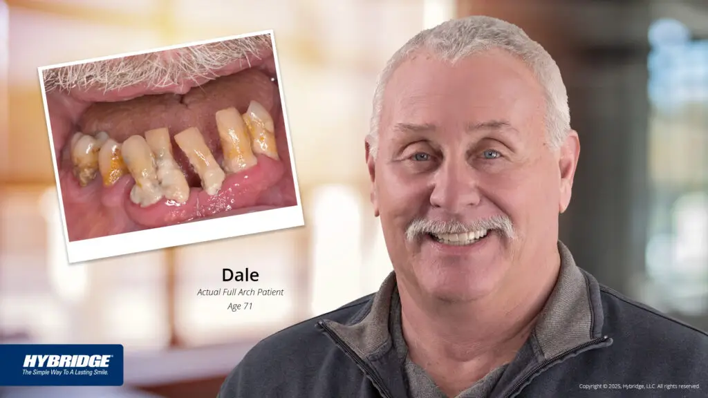 Dental Implants near Strongsville, OH