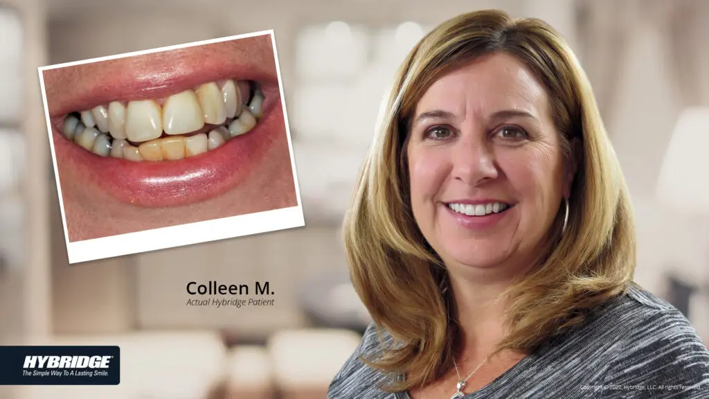 Full Arch Rehabilitation near Broadview Heights, OH